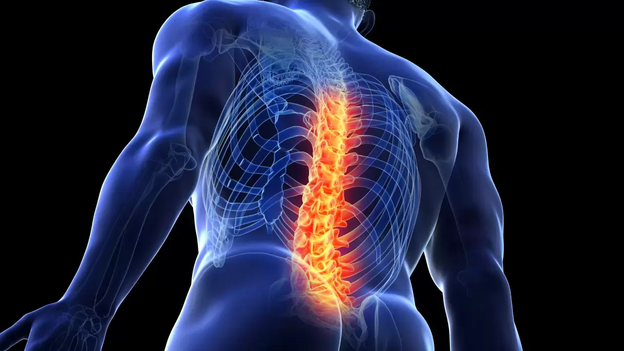 Rückenschmerzen Golfschwung Rückenschmerzen im Golfsport vermeiden2
